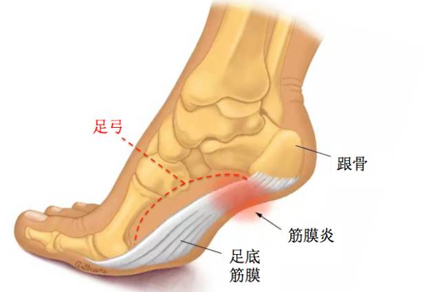 脚后跟的图片结构图图片